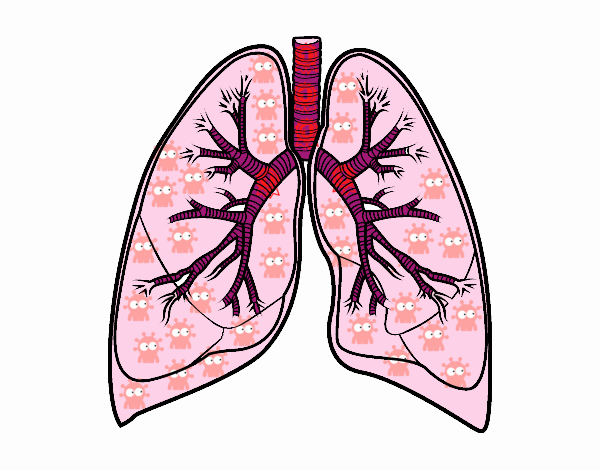 Pulmones y bronquios infectados de COVID-19