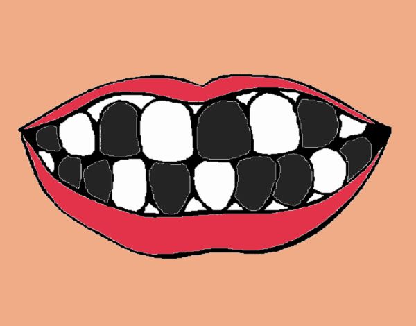 Boca con dientes chuecos😂😂😂 😂XD