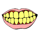 Dibujo Boca y dientes pintado por gingivtis