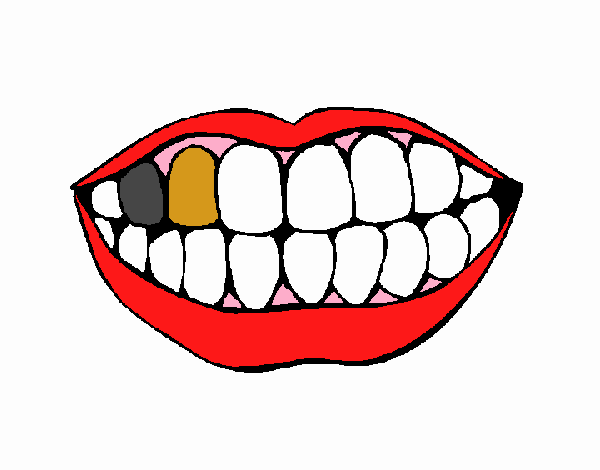 dientes sucios