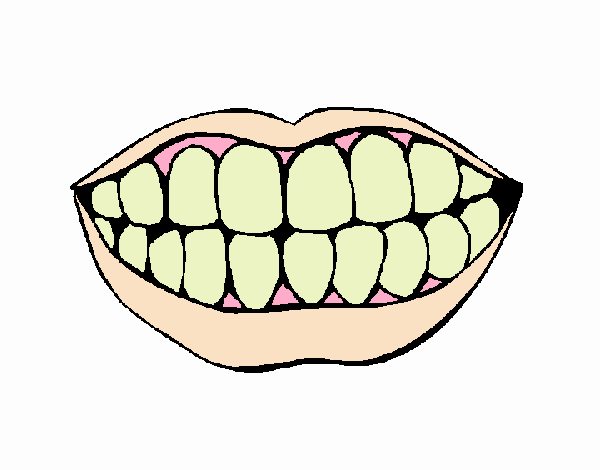 dientes sucios (original)