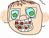 Niño con aparato dental 1